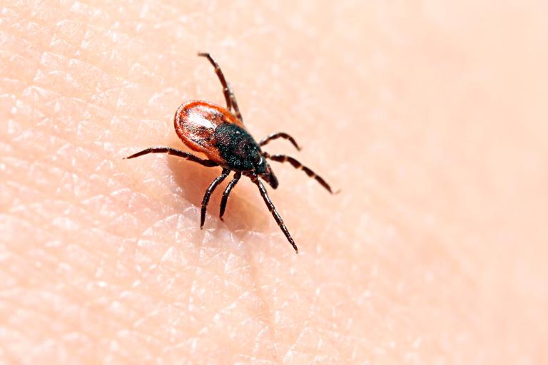 a tick on human skin